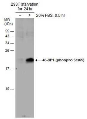 Western Blot: 4EBP1 [p Ser65] Antibody [NBP3-13171]